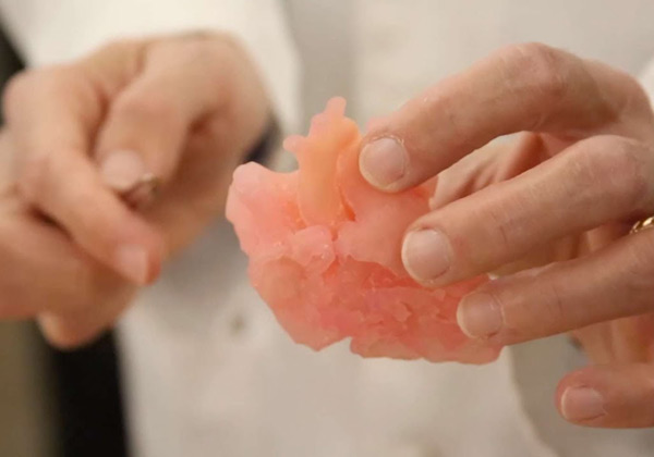 3D-печать изменила проведение хирургических операций в больнице Университета Дьюка