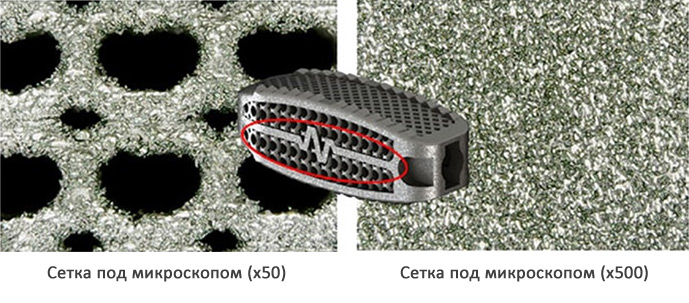 Сетка Partner, изготовленная на 3D-принтере EP-M250, под микроскопом